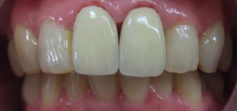 ��Ԃɂ�鎕���ю��Â̗�